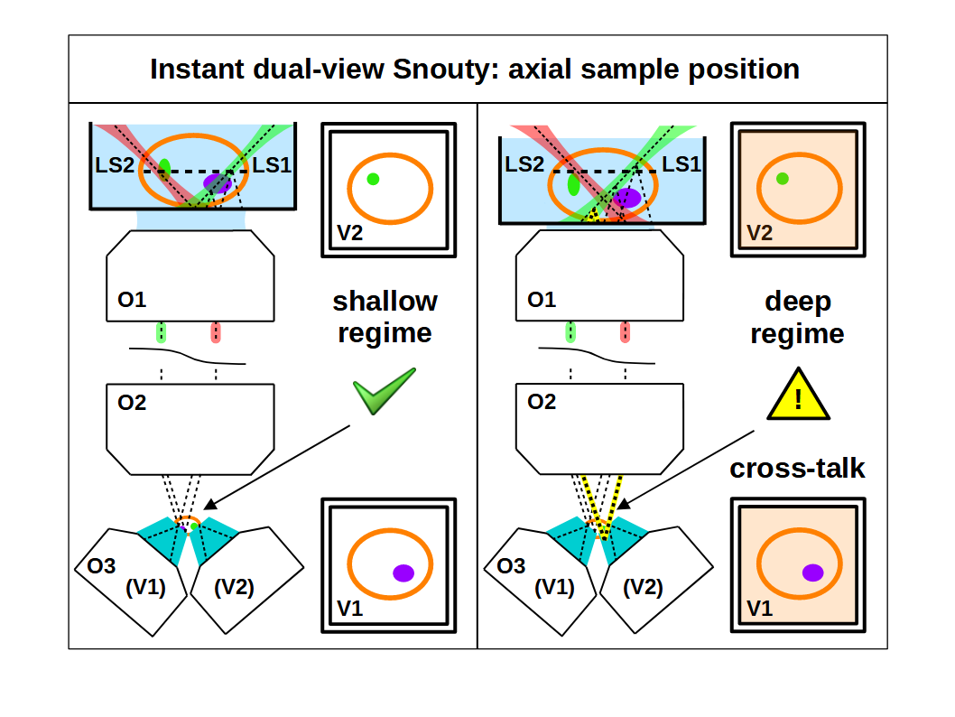 idv snouty axial sample position